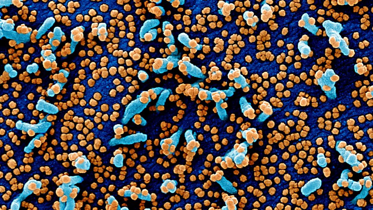 photo close up of cells