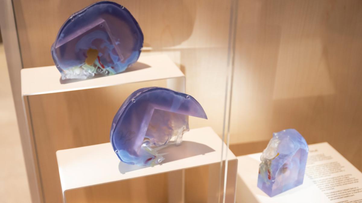 Installation view of Tyree IHealthE 3D Printed Skull. Credit: Cassandra Hannagan